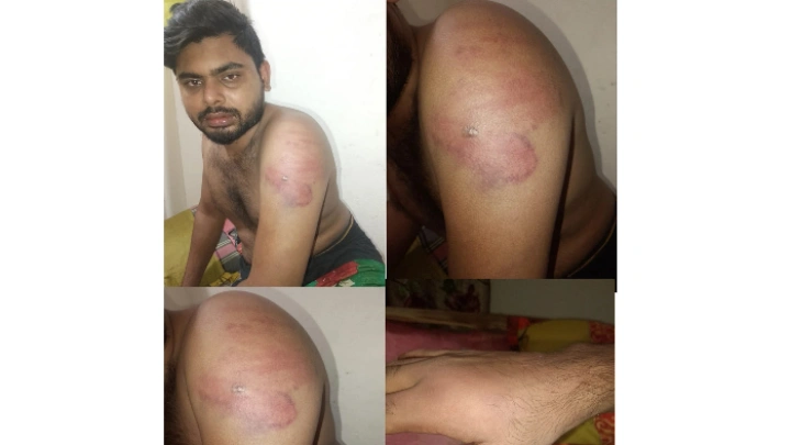 ছবিঃ প্রতিনিধি।